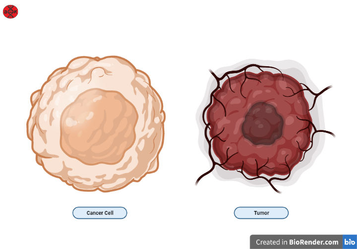 Cancer Vs Tumor