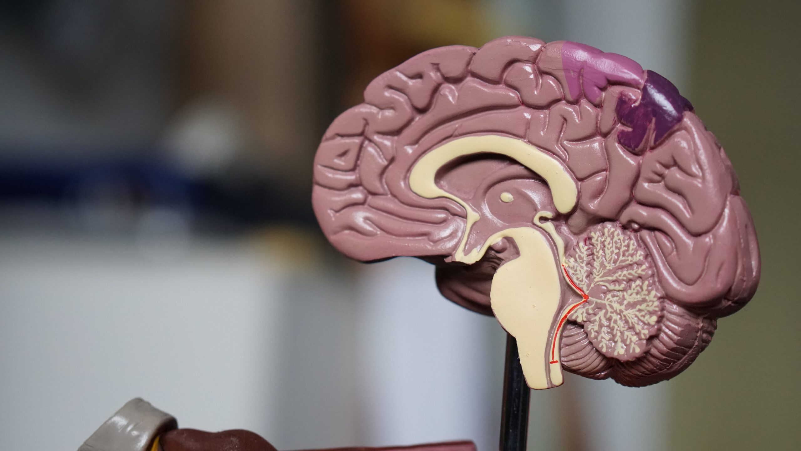 Genetic risk-factor overlap between Alzheimer's disease and vascular dementias