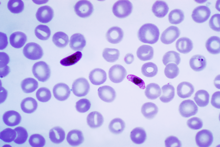malaria treatment drugs