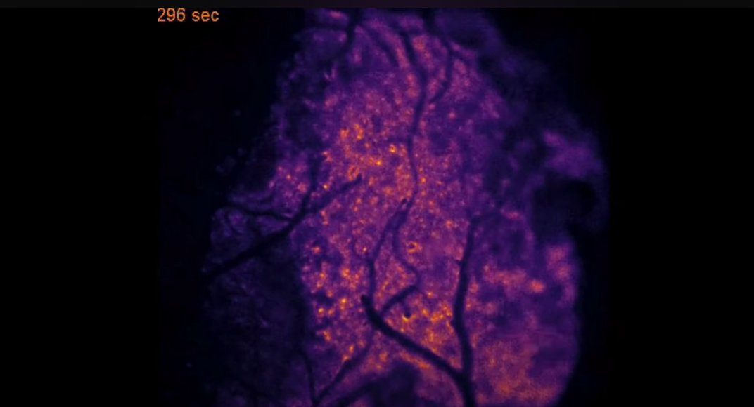 brain image
