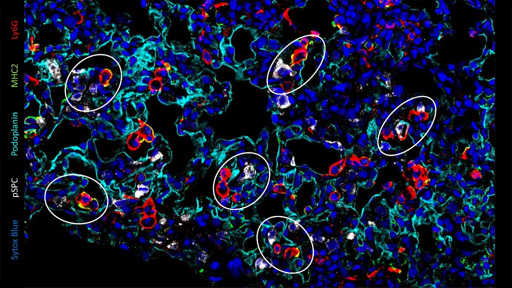lung repair