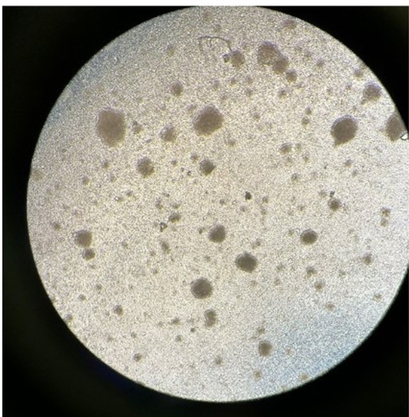 vaccine development reserach